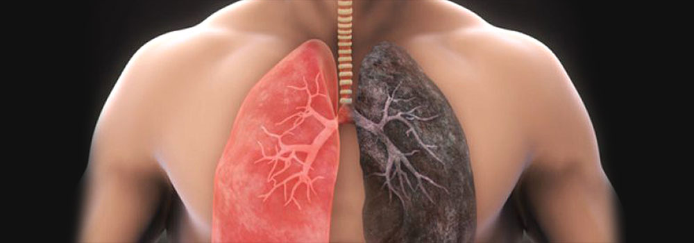 Lung Disease